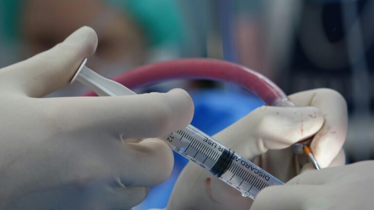 Acute Hemodialysis (AHD): A Life-Saving Treatment for Critical Kidney Injury